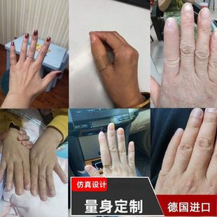 假肢假手指仿真脚趾残疾人义肢半指德国进口硅胶美容手套量身定做