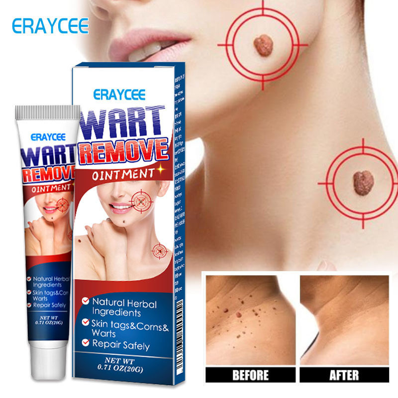 ERAYCEE跨境亚马逊独立站鸡眼 skin tag remover扁平尤祛wart膏