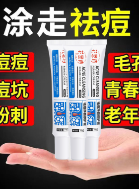 中国花恩诗淡化痘印闭口粉刺黑头