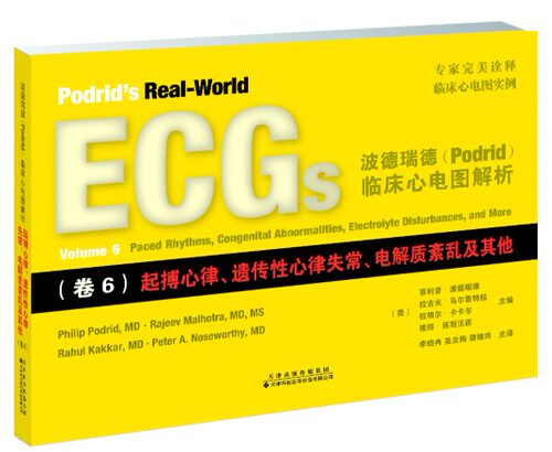 心电图解析