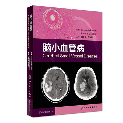 正版现货 脑小血管病 黄勇华 石文磊 人民卫生出版社