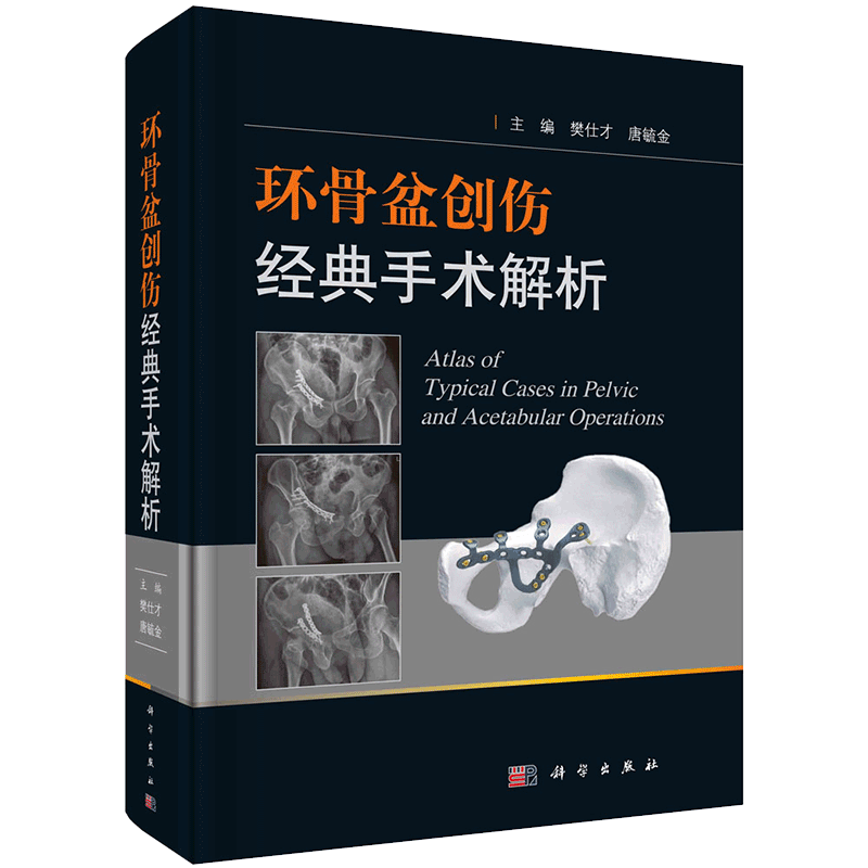 现货 环骨盆创伤经典手术解析科学出版社樊仕才唐毓金9787030659781