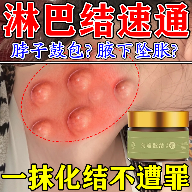 【一抹消】淋巴结消散膏治愈万人