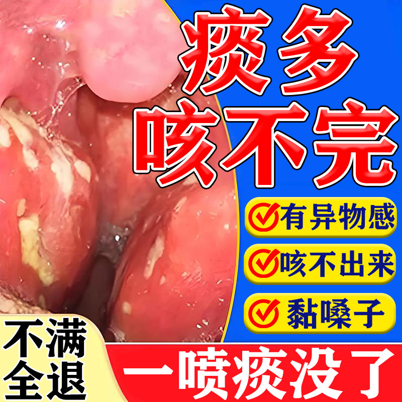 嗓子老有痰异物感粘嗓子喷雾剂