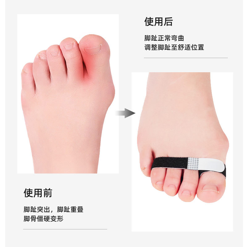 弹力脚趾手指绑带脚趾分趾器日夜用重叠拇指外翻拉伸带小布条