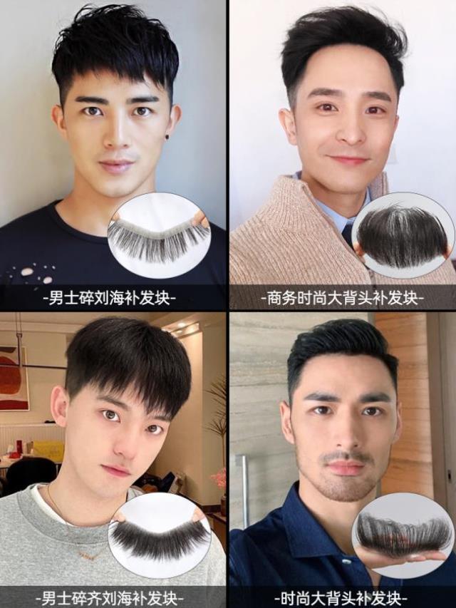 男士假发片前额隐形发际线贴真发假发男头顶补发块男生m型假刘海