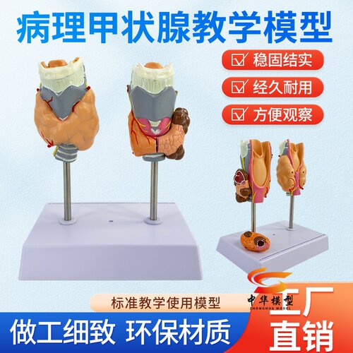 蓝蝶模型甲状腺病理甲亢甲低