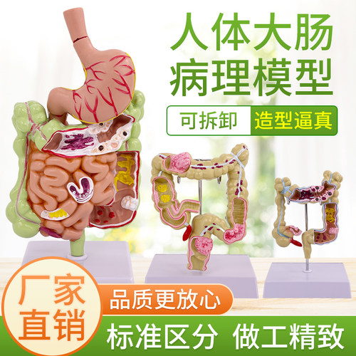 结肠大肠模型中华教学