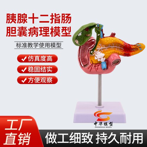 中华模型胰腺十二指肠胆囊病理