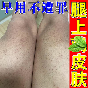鸡皮疙瘩腿上长鸡皮疙瘩粗糙颗粒小黑点身上干燥长小疙瘩大腿手臂