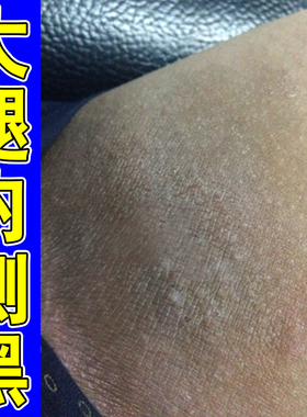 大腿内侧黑色素沉淀去腿两侧干燥粗糙发黑除屁股腿部黑沉淀外用膏