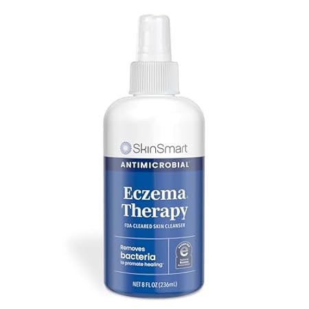 SkinSmart Antimicrobial Eczema Therapy with Hypochlorous