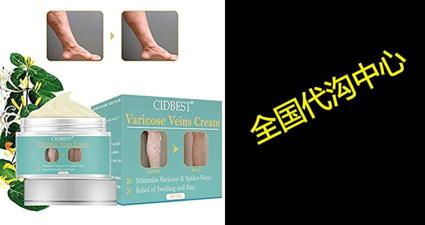 varicose cream, varicose ve cream, varicose vein treat