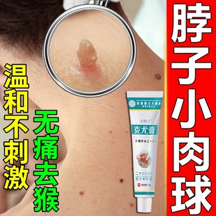 草本克疣膏去脖子上的小肉揪球尤膏全身尤脖子小肉粒清洁