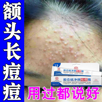 淋巴痘腮边痘脸上痘痘凹洞修复去青春痘粉刺闭口痤疮祛痘印神器
