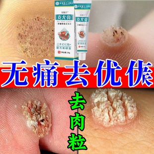 草本克疣膏去脖子上的小肉揪球尤膏全身尤脖子小肉粒清洁