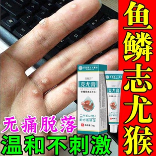 草本克疣膏去脖子上的小肉揪球尤膏全身尤脖子小肉粒清洁