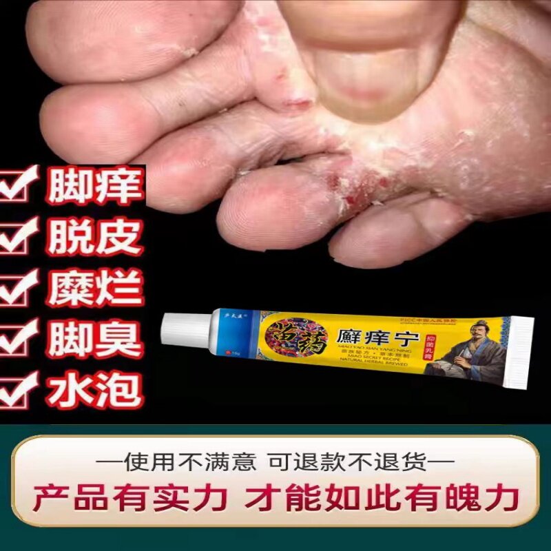 窝状角质松解症沙虫脚药脚底蜂窝状发白小水泡脚丫子痒烂脚脚酸臭