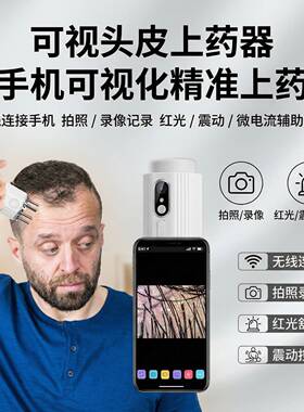 可视米诺头皮红光滚珠检测仪