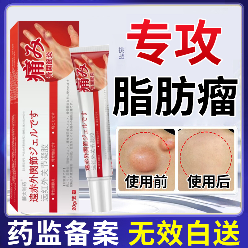 葆元制药皮下脂肪瘤消瘤膏特肿硬块皮肤纤维瘤去腺囊肿效蓖麻xl