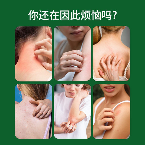 狼毒蛇床子去祛痒膏官方旗舰店正品止皮肤瘙痒抑菌乳膏直播款3cd