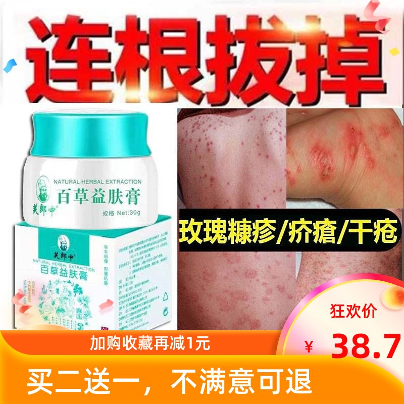 治疗玫瑰糠疹专用药膏苗家百草益肤膏疥疮结节皮肤瘙痒治干疮的药