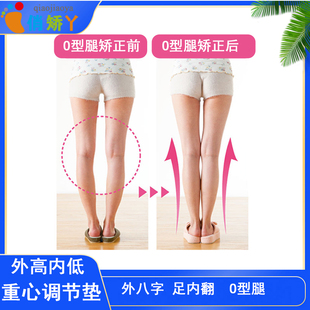 足内翻矫正鞋垫成人O型腿纠正神器外八字校正O形腿外侧磨损俏脚丫