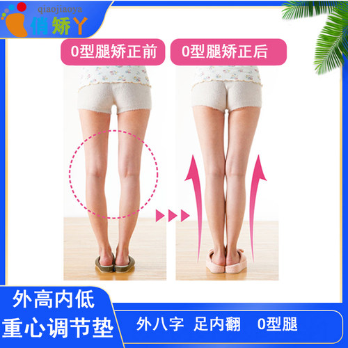足内翻矫正鞋垫成人O型腿纠正神器外八字校正O形腿外侧磨损俏脚丫