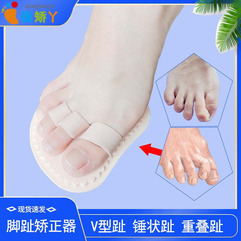 成人脚趾弯曲矫正器脚指头重叠纠正爪状趾锤槌状趾弓形抓地趾儿童