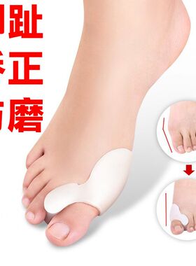 脚趾内外翻矫正器大拇指