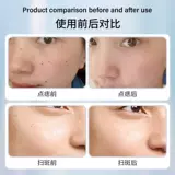 Лазерная ручка для удаления небольших пятен от плоти, удаляет веснушки, подмышки и шею обезьяны, нитевидные плоские бородавки, инструмент gy