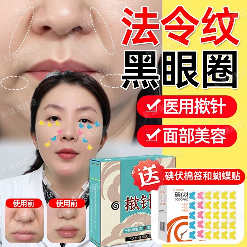 【医院中款】揿针穴位贴法令纹