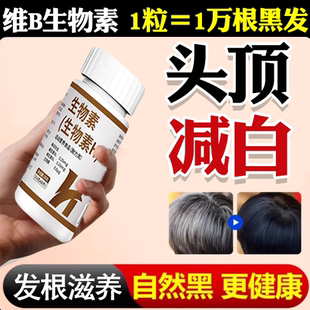 维生素b族防脱发生发正品搭生物素防脱发维生素h治调白头发转黑发