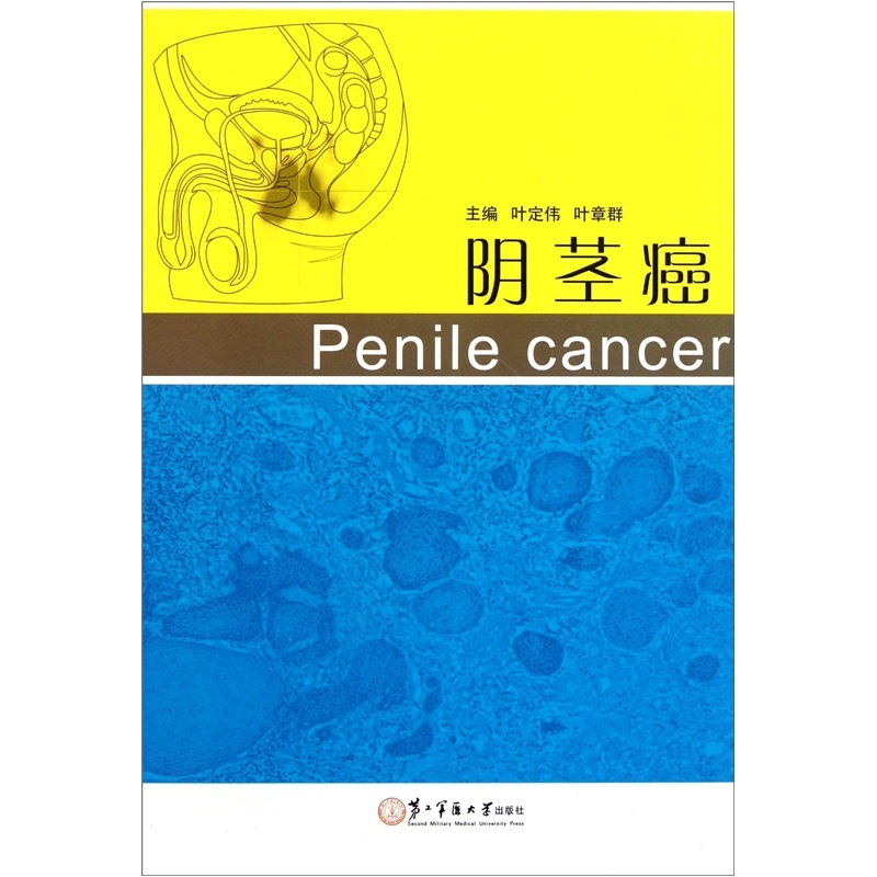 现货 阴茎癌 第二军医大学出版社
