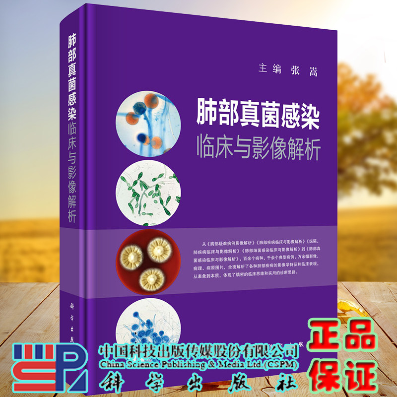 现货 肺部真菌感染临床与影像解析科学出版社张嵩9787030657626