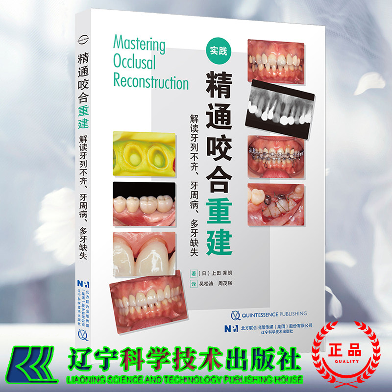 正版现货 精通咬合重建 解读牙列不齐 牙周病  多牙缺失 日 上田秀朗 著 吴松涛 周茂强 译 辽宁科学技术出版社9787559130266