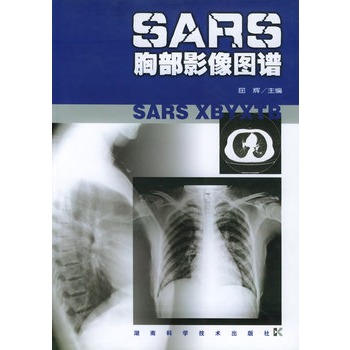 ★SARS胸部影像图谱 屈辉  /湖南科技出版社