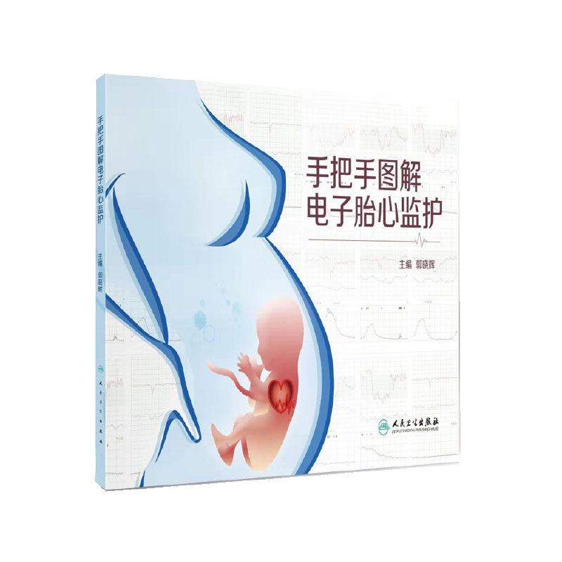 现货 手把手图解电子胎心监护 人民卫生出版社 郭晓辉 9787117282581