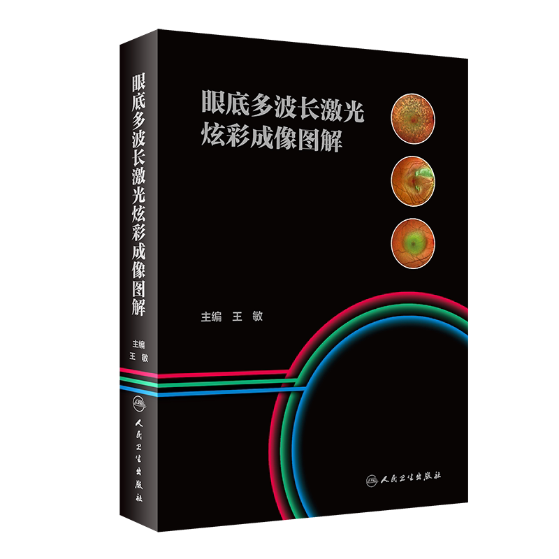 眼底多波长激光炫彩成像图解 王敏主编 青光眼神经眼科疾病白内障散光手术视觉质量眼底影像技术视网膜脉络膜疾病眼科医生读图谱