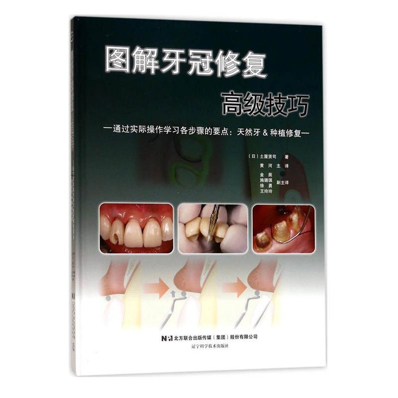 现货 图解牙冠修复gao级技巧 土屋贤司 黄河主译 辽宁科学技术出版社