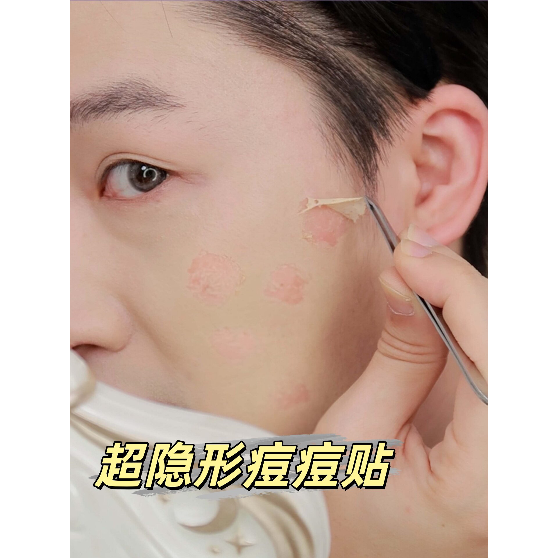 隐形假皮遮瑕贴面部痘痘贴修复消炎痘印医用型化妆超薄面部疤痕贴