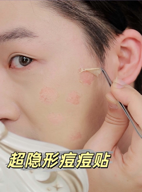 隐形假皮遮瑕贴面部痘痘贴修复消炎痘印医用型化妆超薄面部疤痕贴