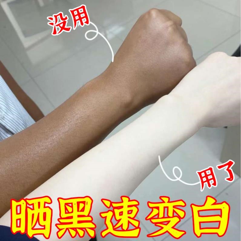 晒黑了修复快速变白男士女生胳膊手臂脖子脸部晒后黄皮肤美白修护