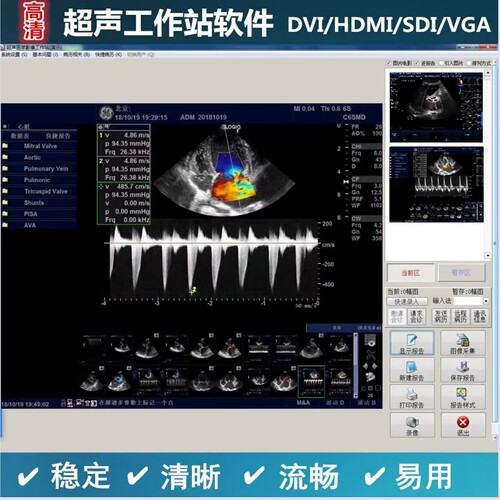 XBA鑫佰安正版加密锁时间不限