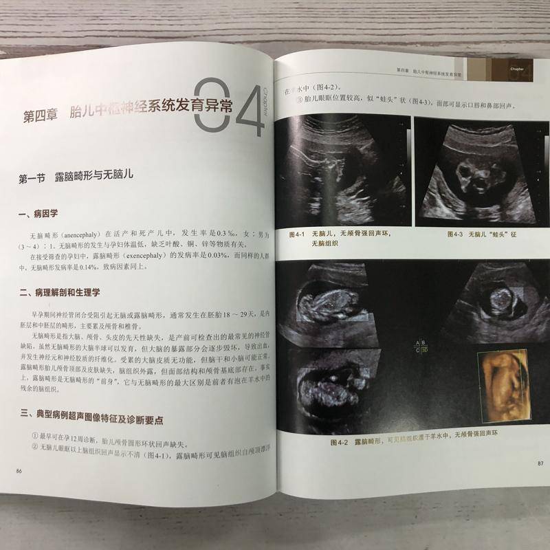 产前诊断与胎儿畸形超声图解罗红 书工业技术书籍