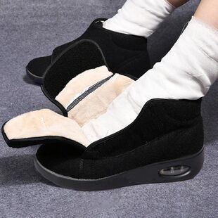 Winter Swollen Women Boots Wide Feet Orthopedics Warm Velvet