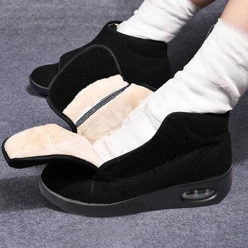 Women Warm Boots Winter Velvet Orthopedics Wide Feet Swollen