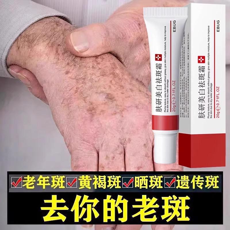 正品去斑霜专治祛老年斑专用脸部去手上手部手背的药膏强力去除