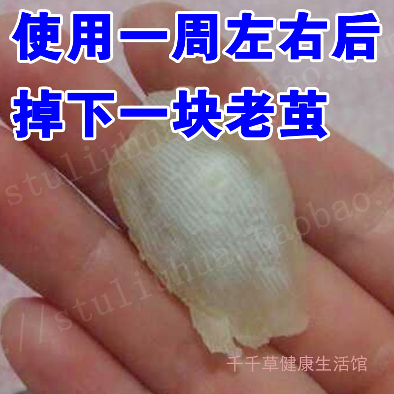 茧子去除消茧灵茧立消除足部老茧茧立净脚底老皮软化剂立洁士脚皮