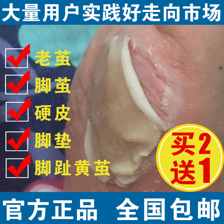 茧子去除消茧灵茧立消除足部老茧茧立净脚底老皮软化剂立洁士脚皮